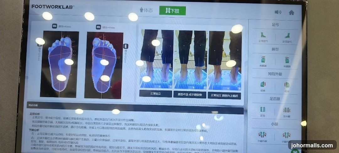 Foot Analysis Display