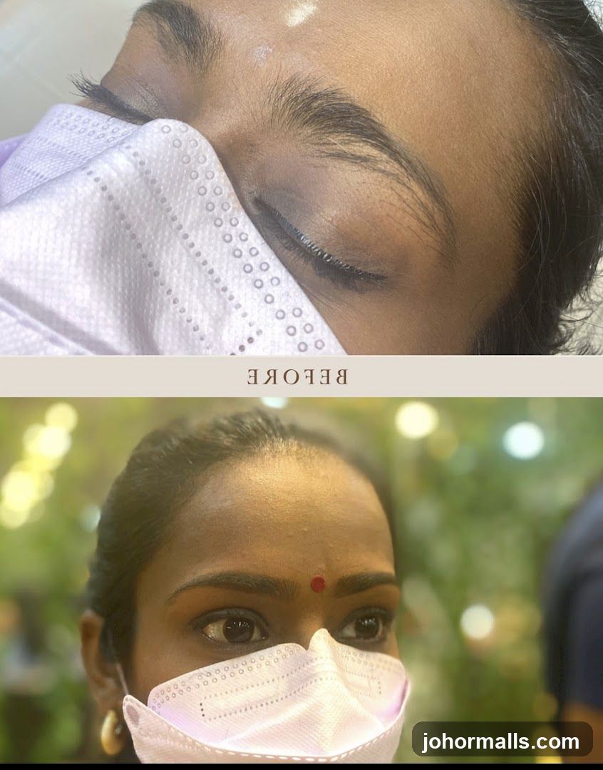 Eyebrow Before and After