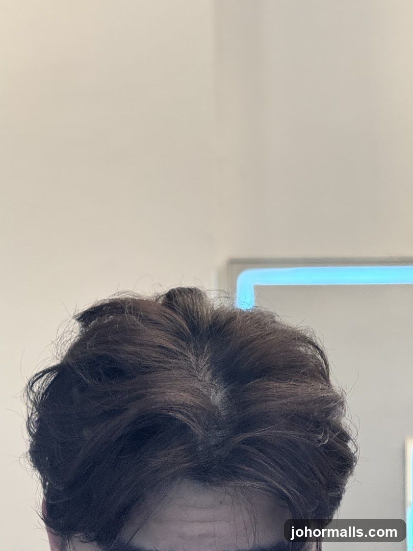 Hair
