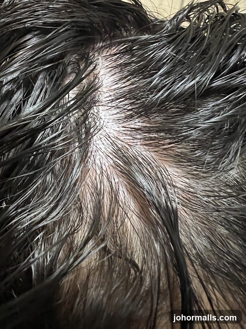Close-up of scalp with dark hair