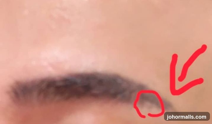 Eyebrow with red markings