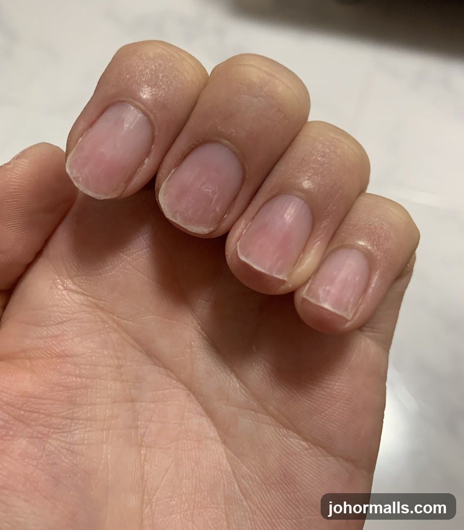 Close-up of unpolished fingernails