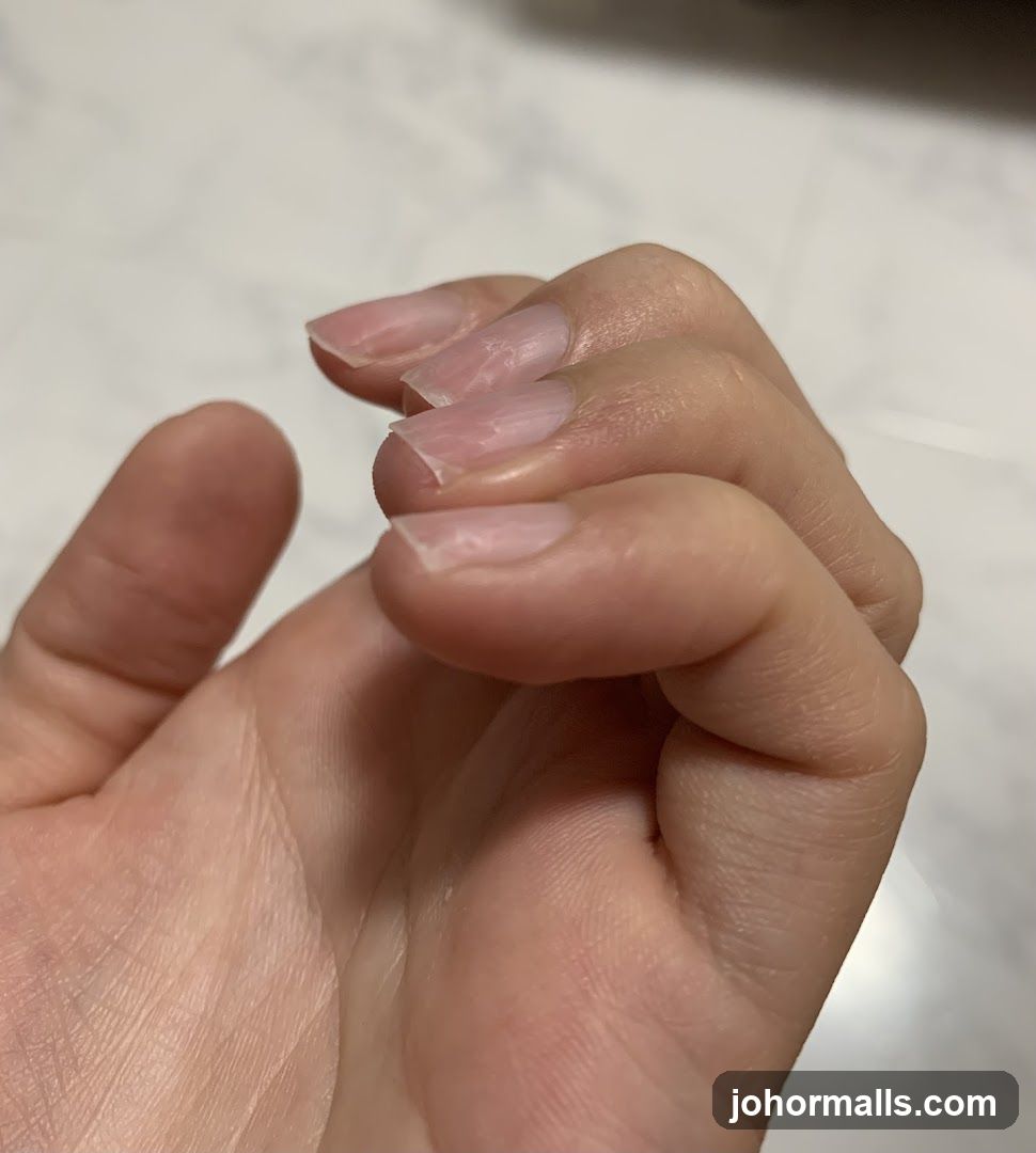 Close-up of a hand with unpolished nails