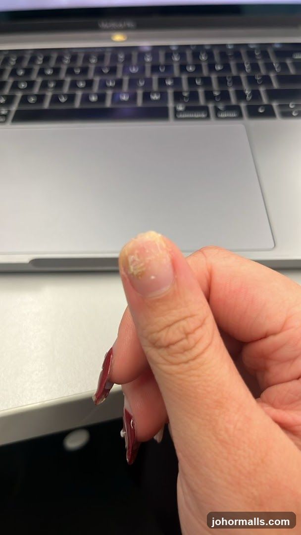 Damaged Nail and Laptop