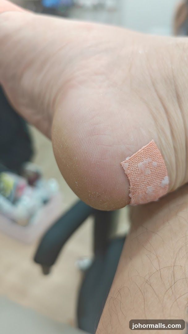 Foot with Band-Aid
