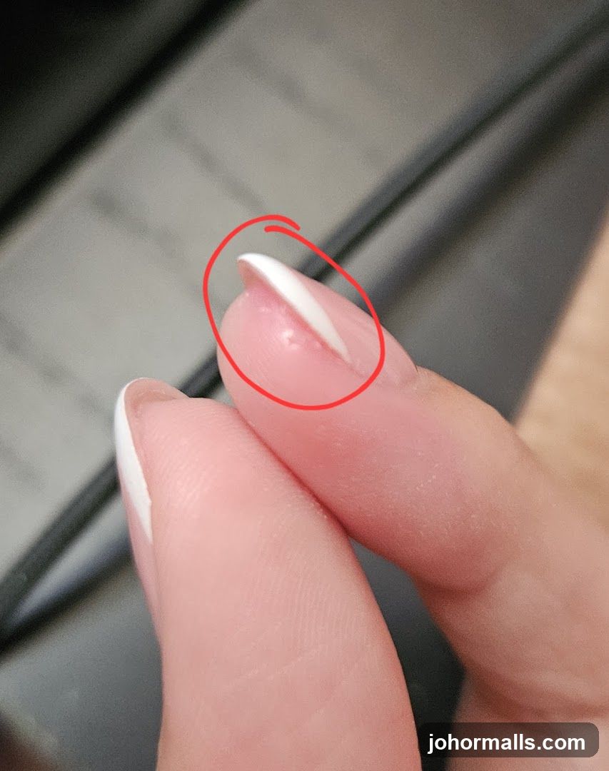 Broken Nail