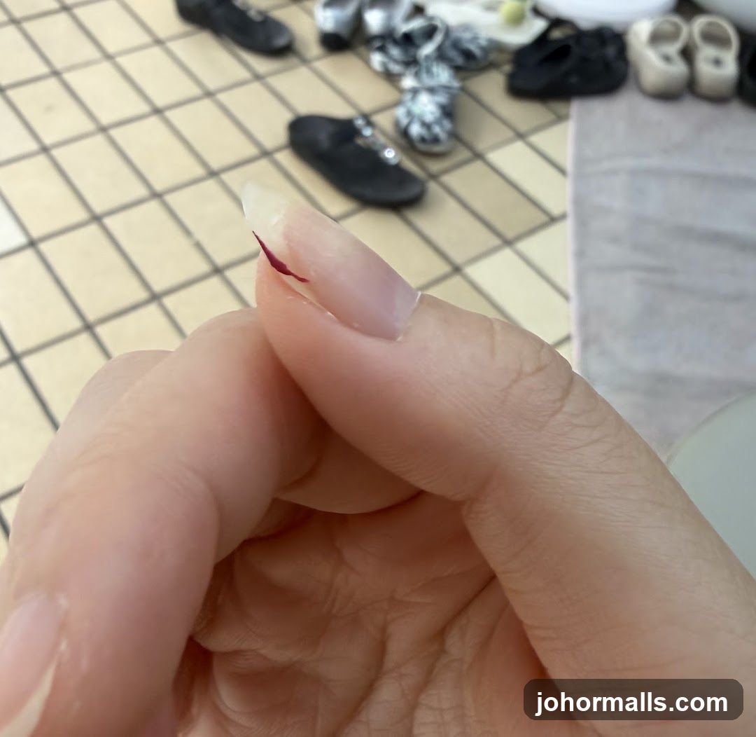 Close-up of a chipped fingernail