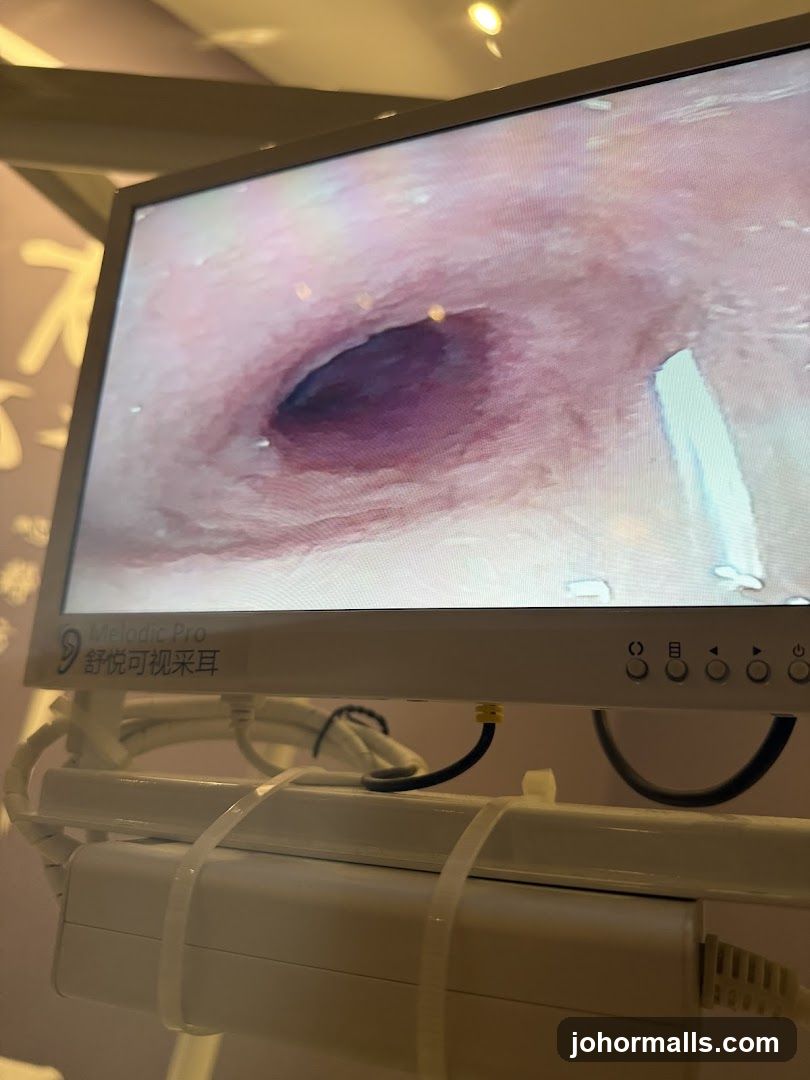 Medical Monitor Display