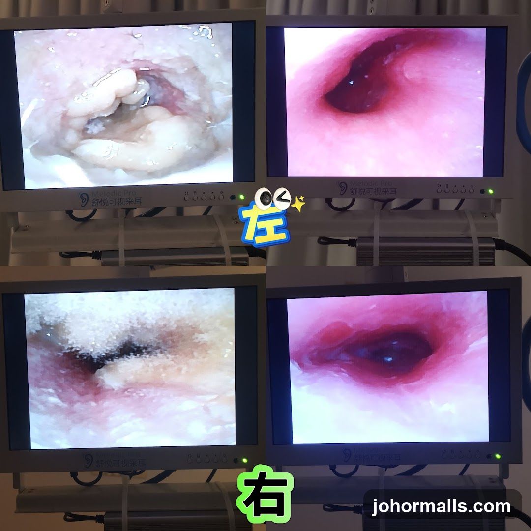 Medical Imaging Screens