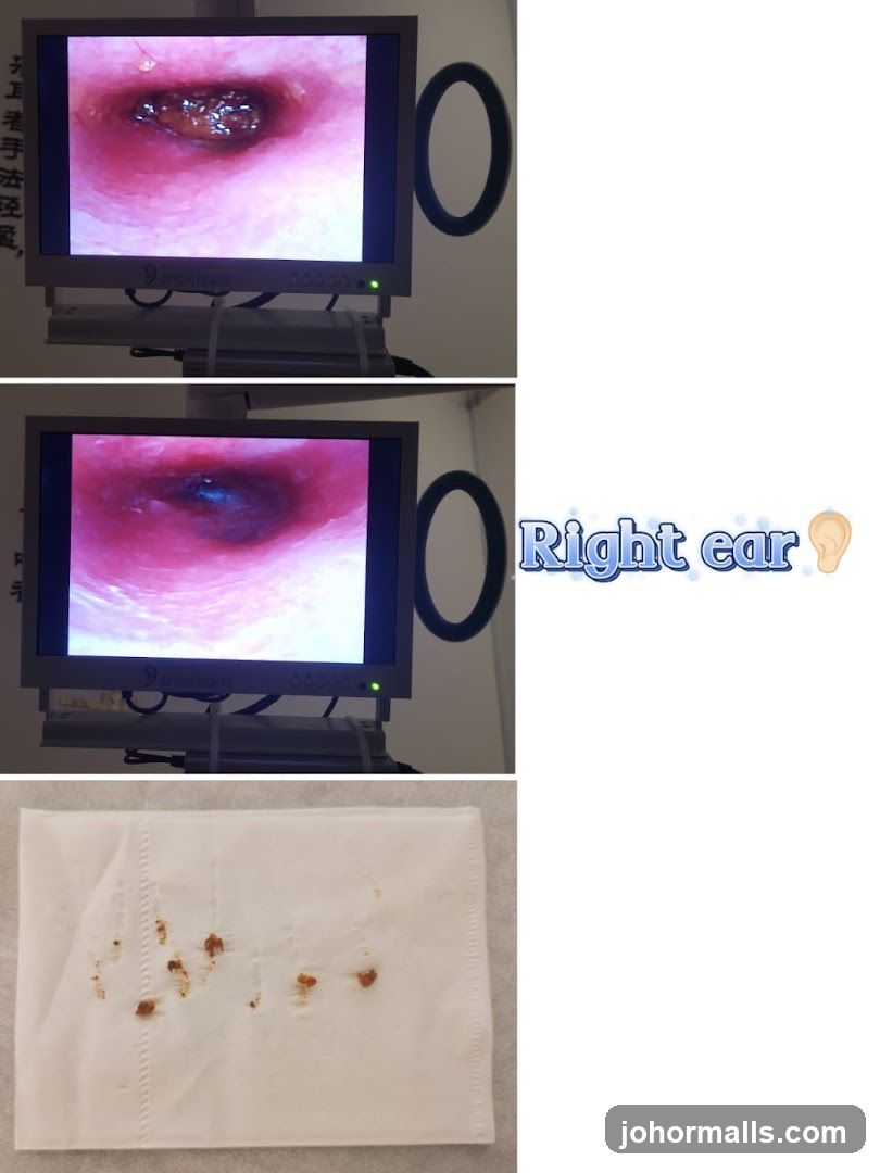 Ear Examination