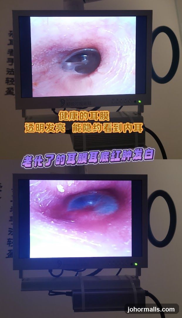 Medical Display
