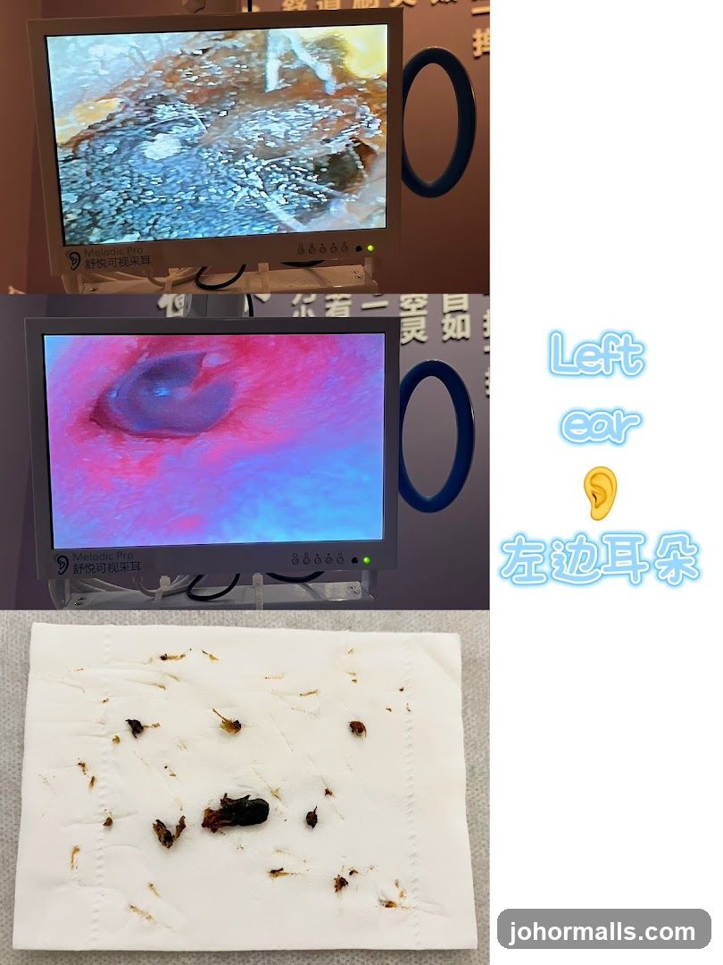 Ear Cleaning Results
