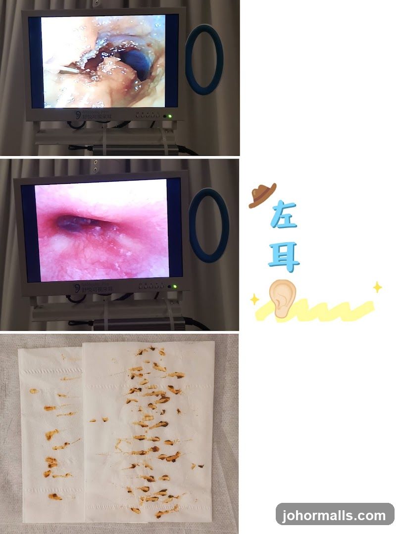 Ear Examination and Cleaning
