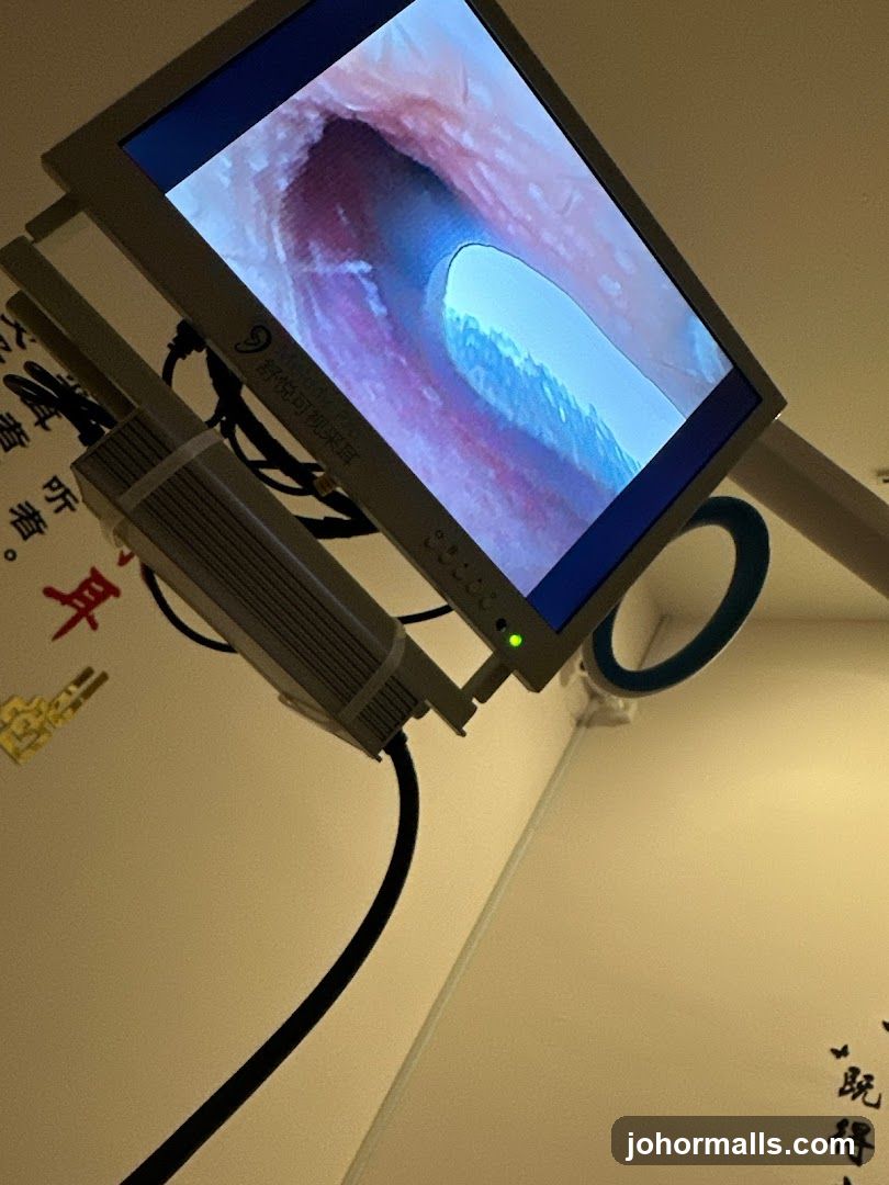 Medical Device Display