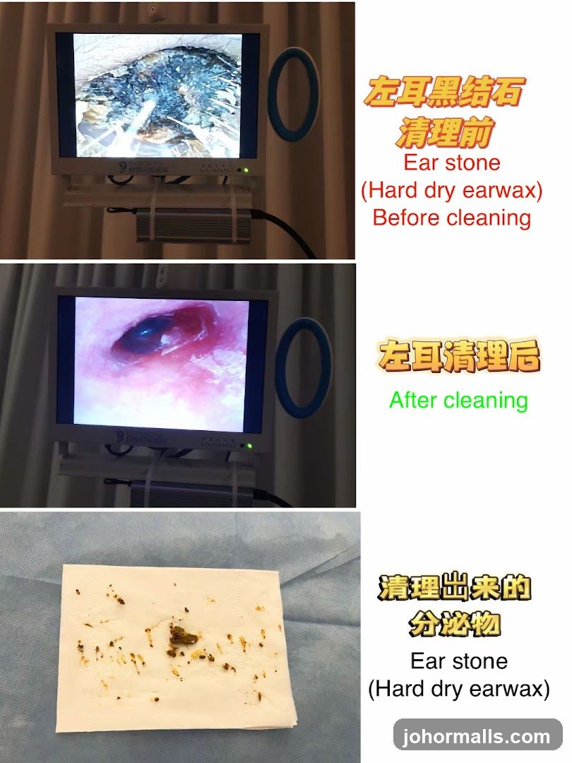 Ear Cleaning Before and After