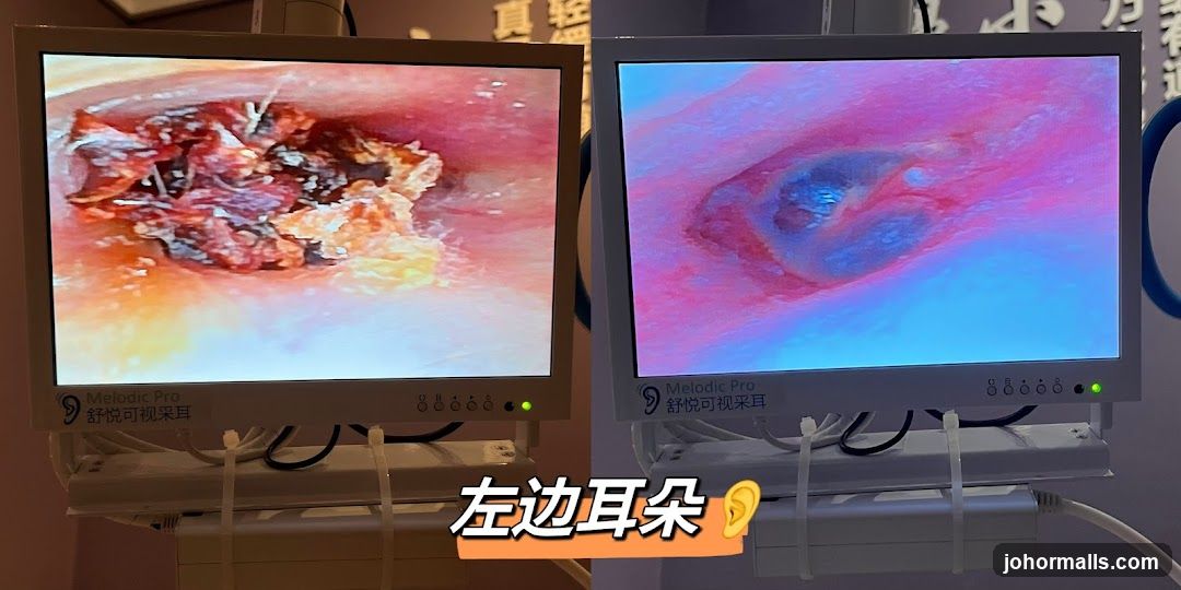 Ear Examination Screens