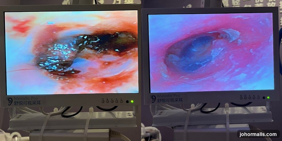 Medical Display Screens