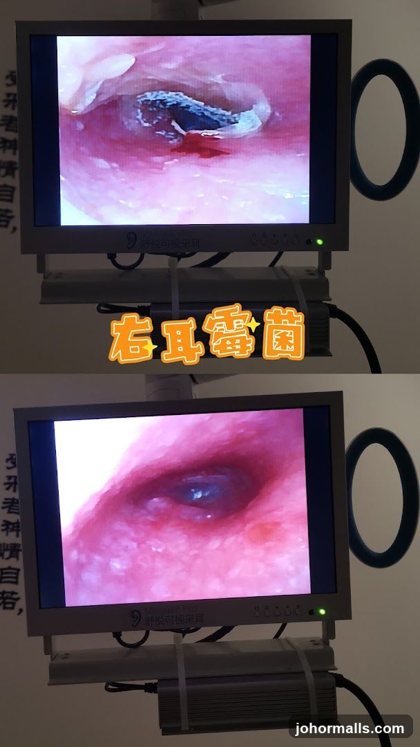 Medical Display