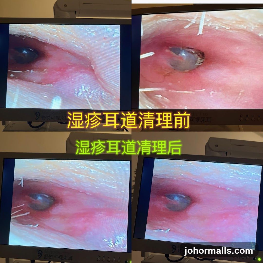 Ear Cleaning Before and After
