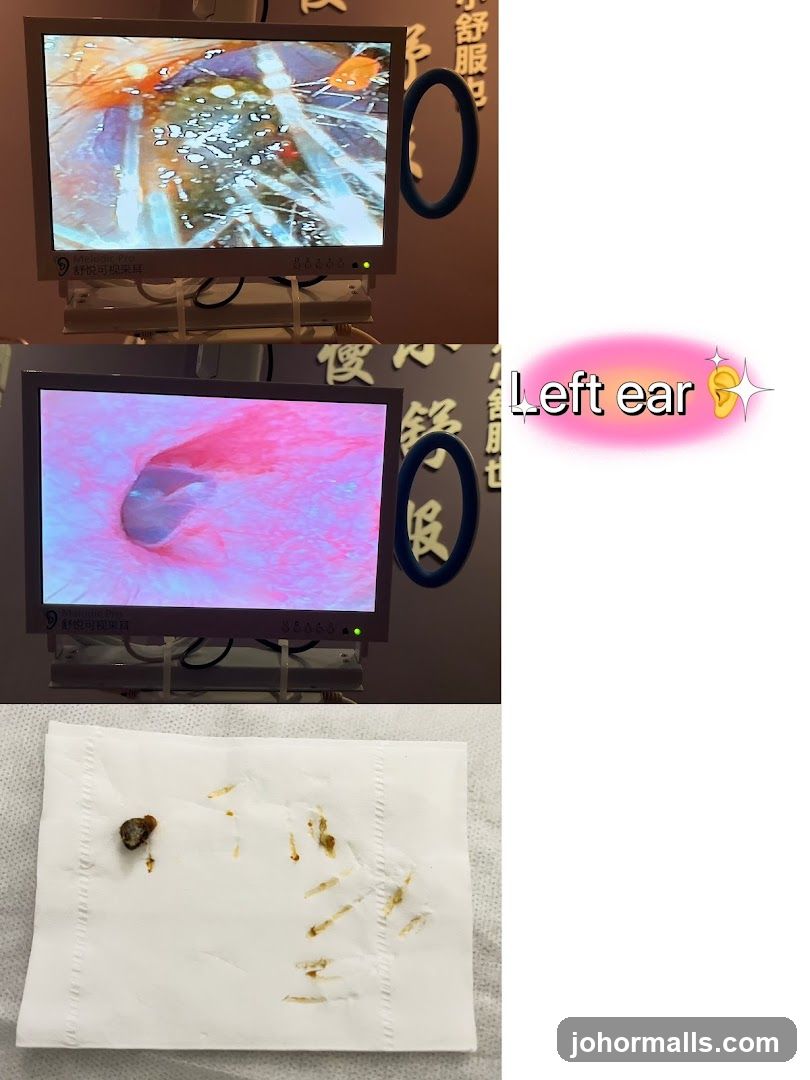 Ear Examination and Removal