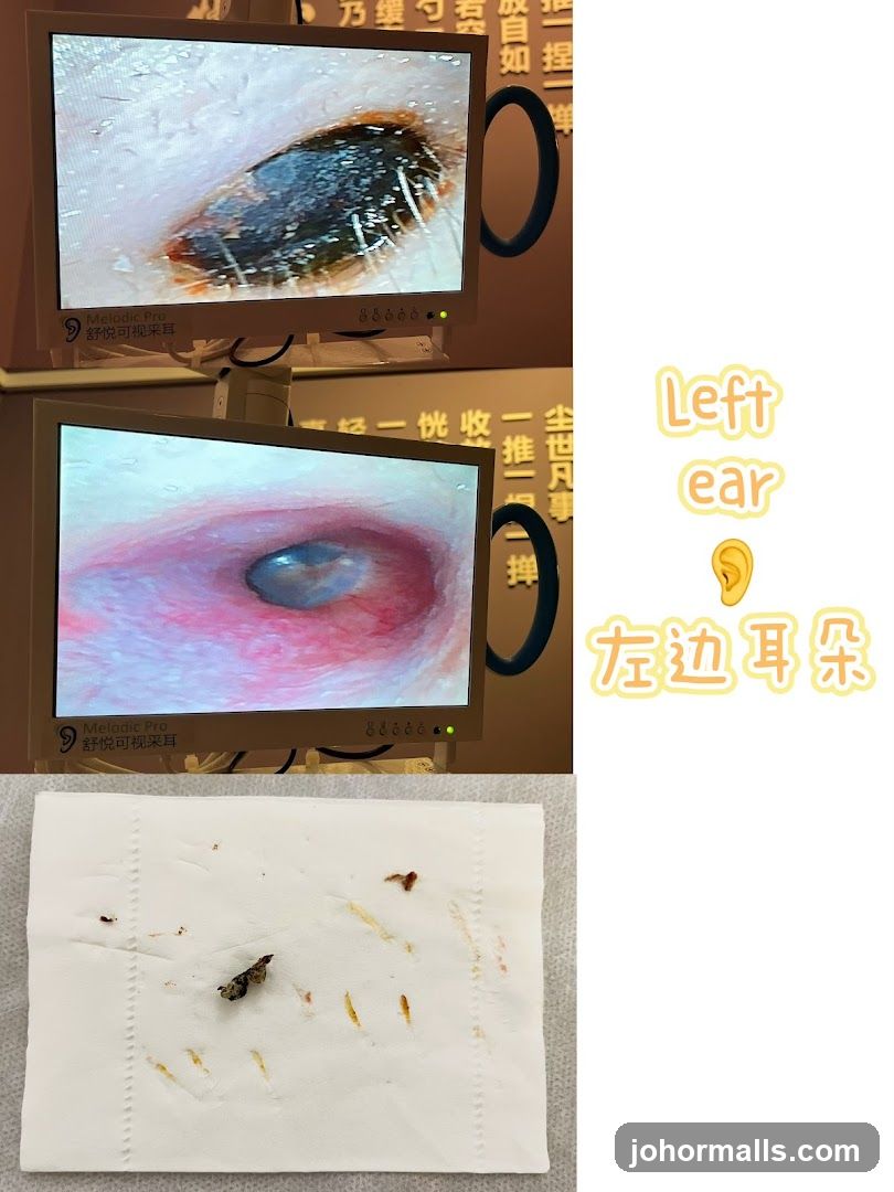 Ear Cleaning Demonstration