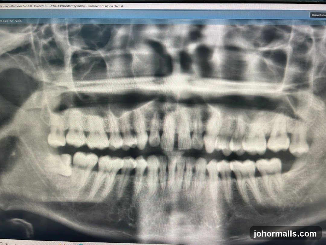 Dental X-ray