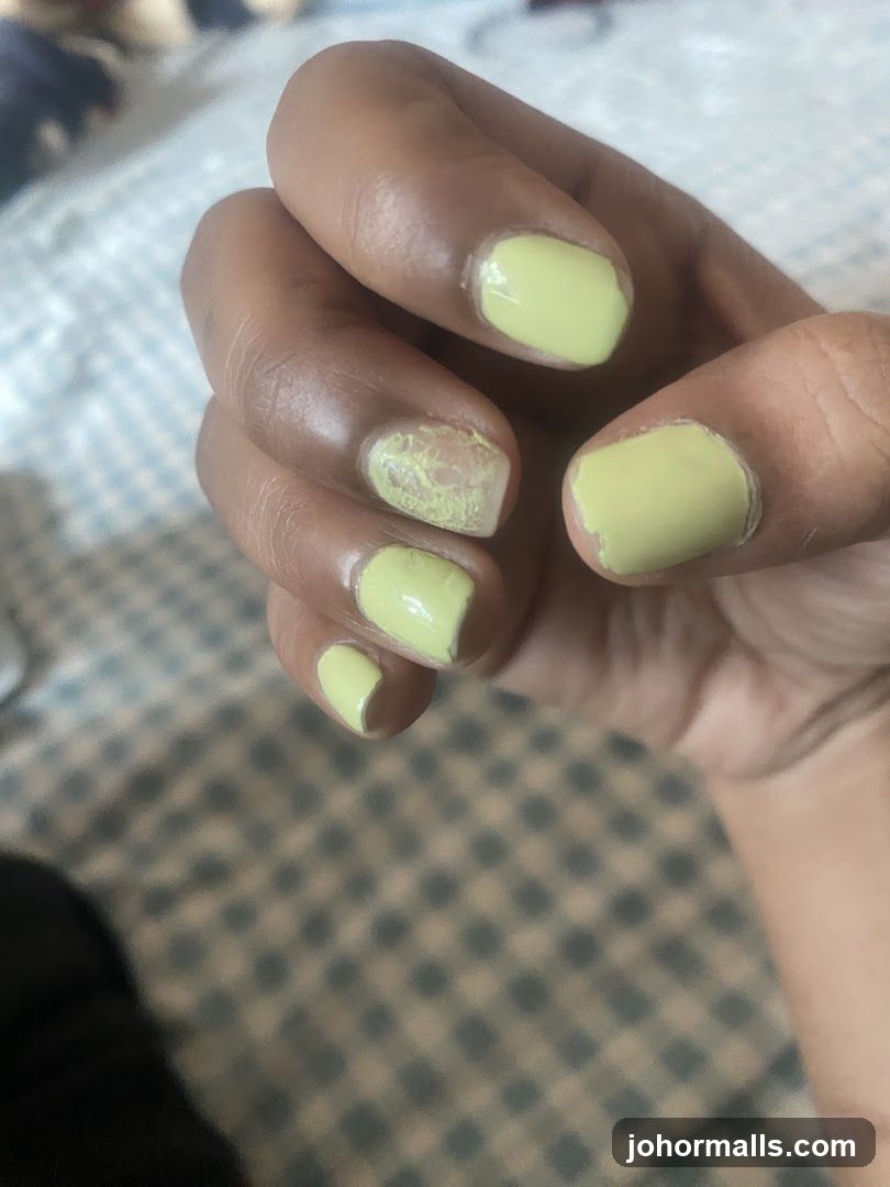 Fingernails with chipped yellow polish