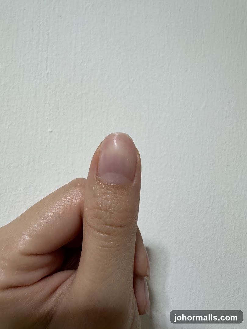 Thumb and Finger