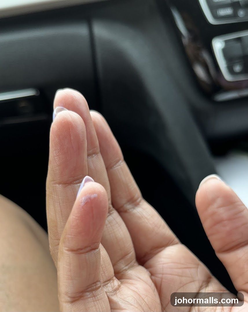 Fingers with lotion