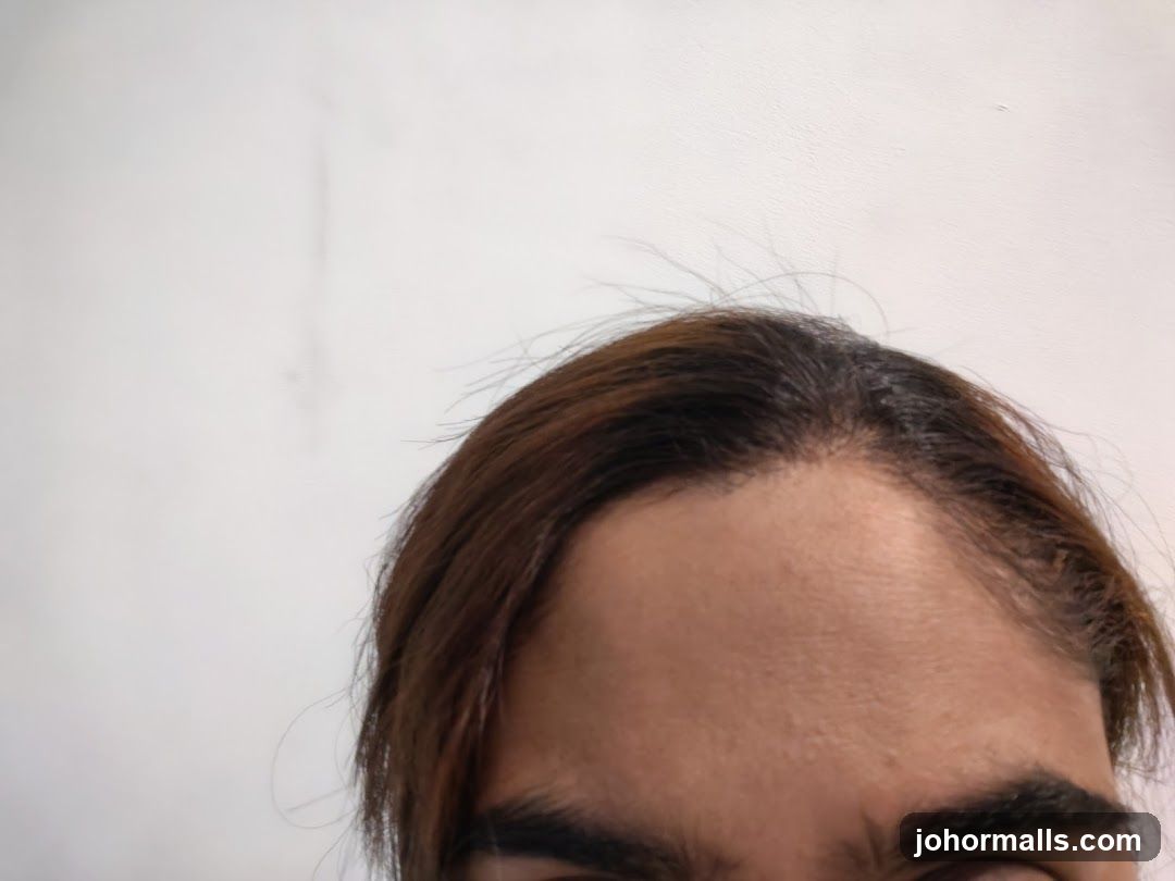 Forehead and Hair