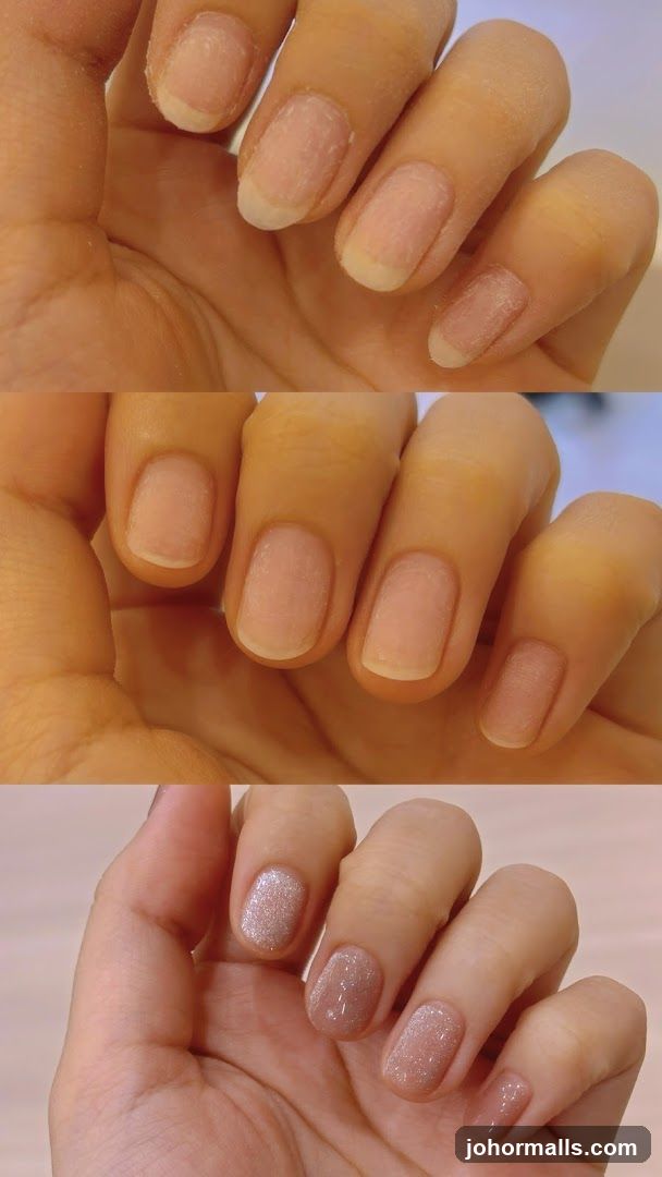 Nail Transformation
