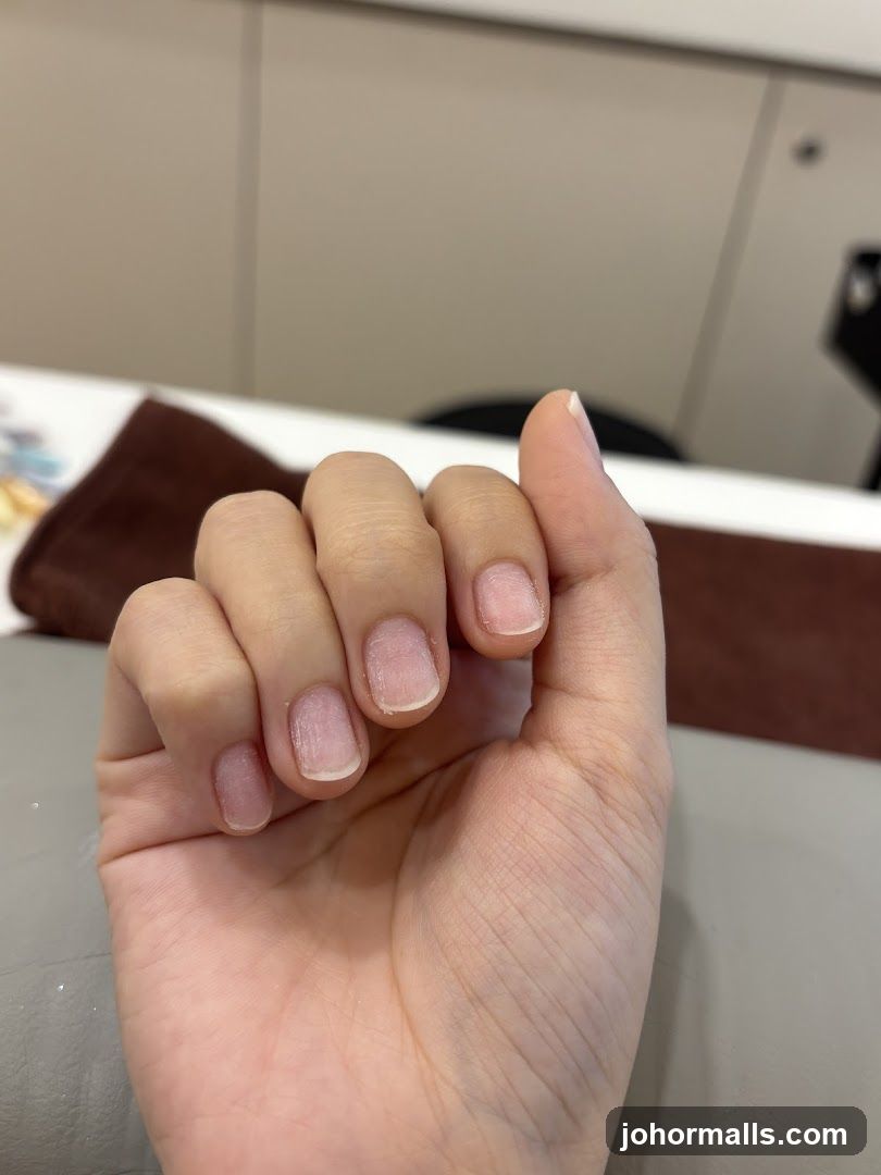 Close-up of a hand with unpolished nails