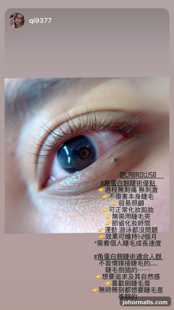 Eyelash treatment benefits