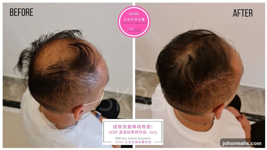 Hair Follicle Simulation Before and After