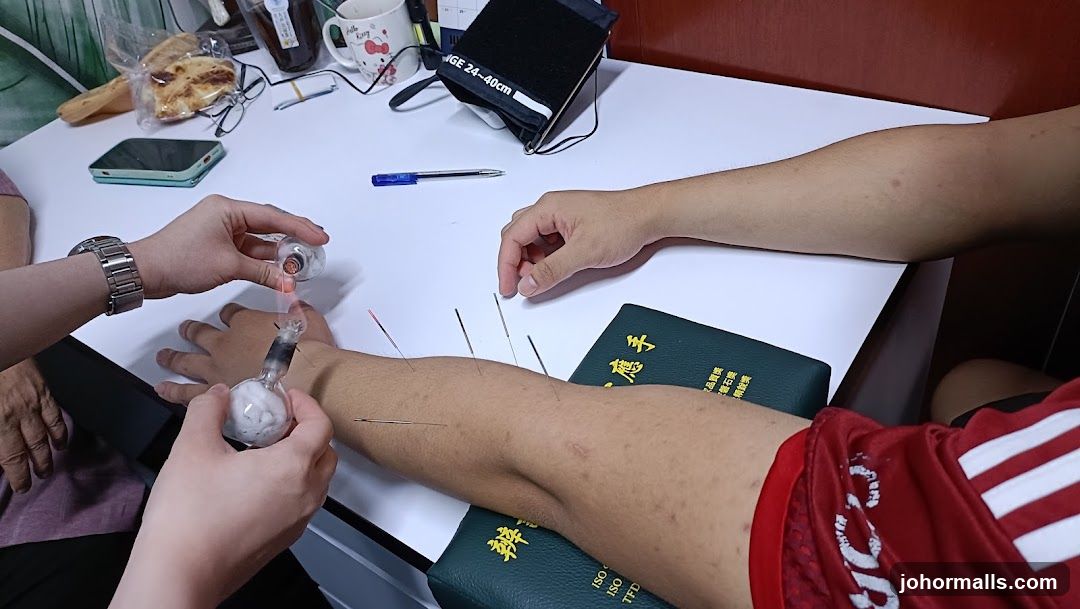 Acupuncture treatment
