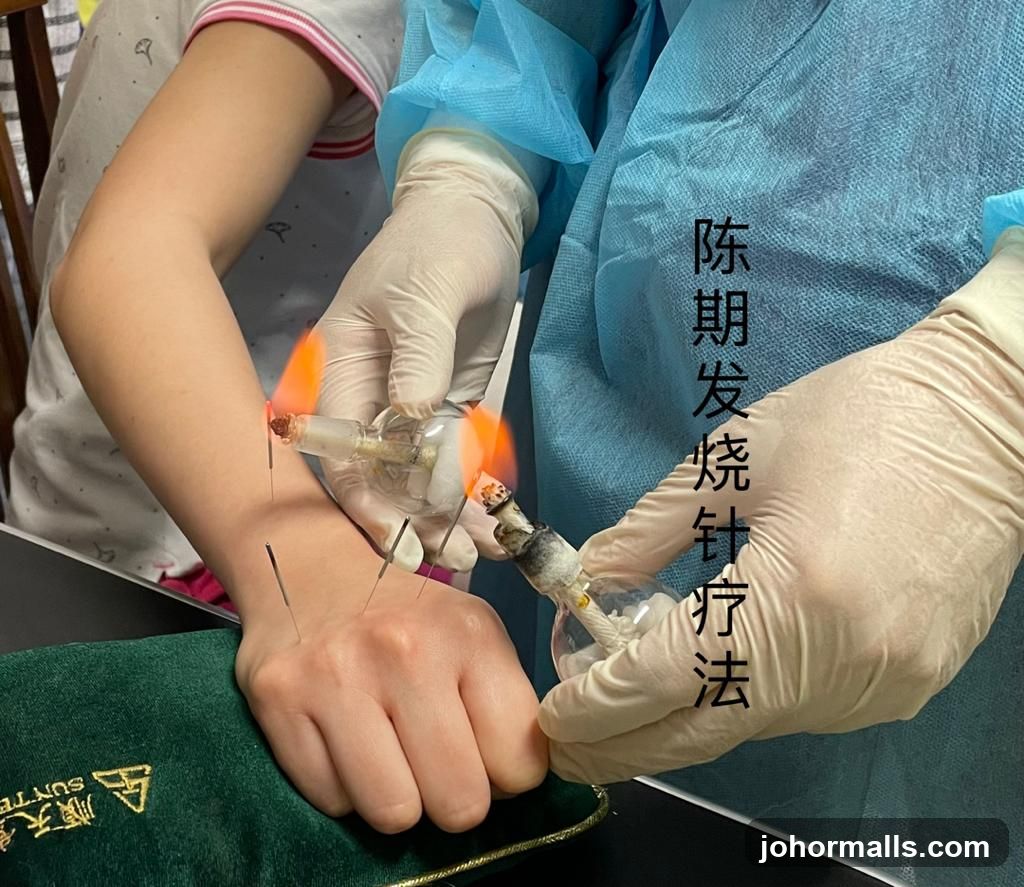 Acupuncture Treatment