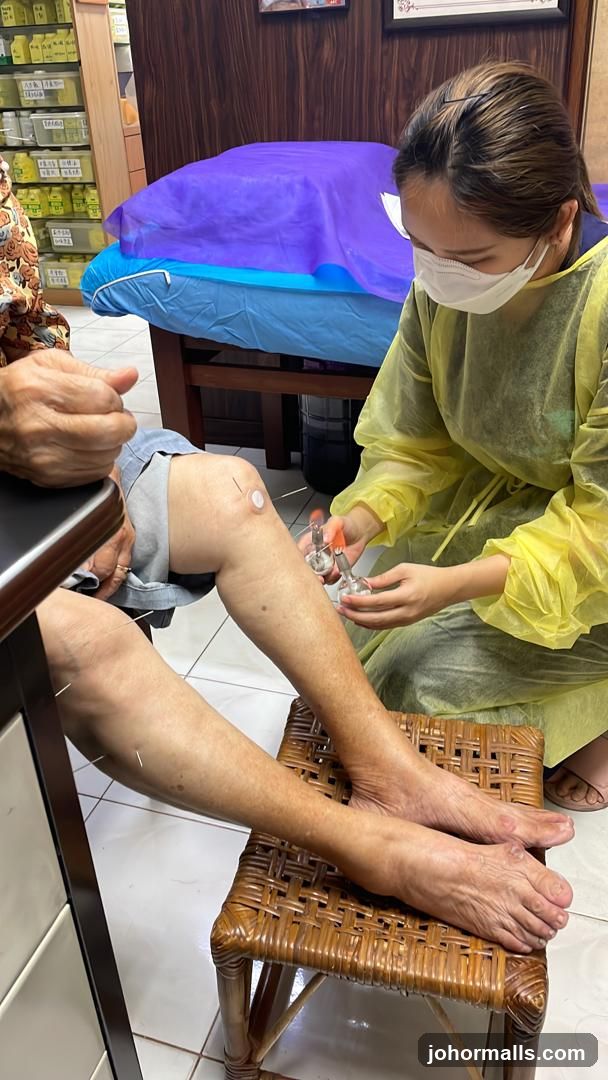 Acupuncture Treatment