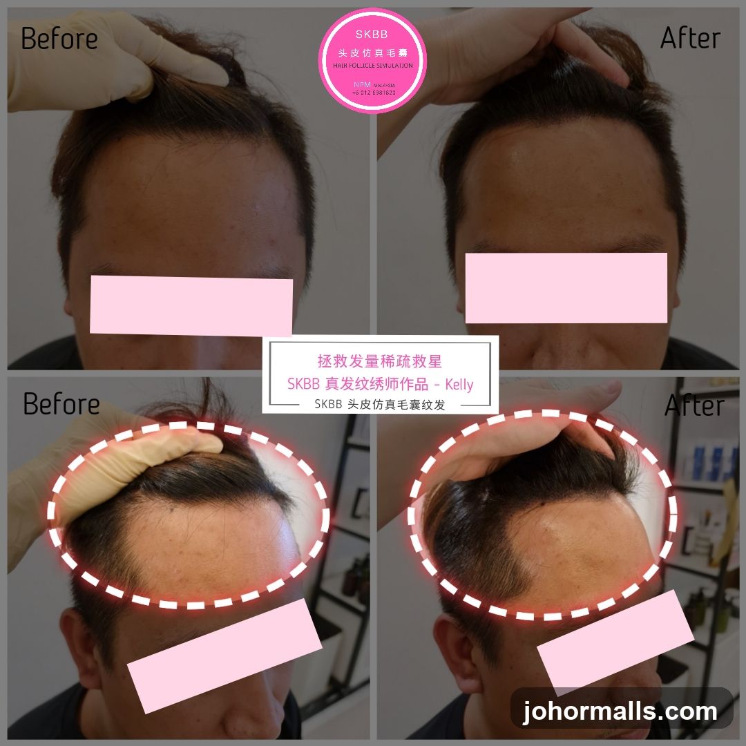 Hair Follicle Simulation Before and After