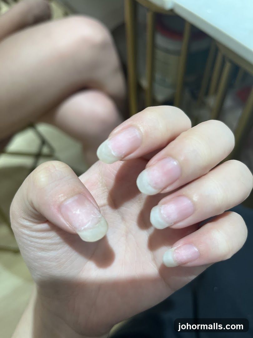 Close-up of unpolished fingernails