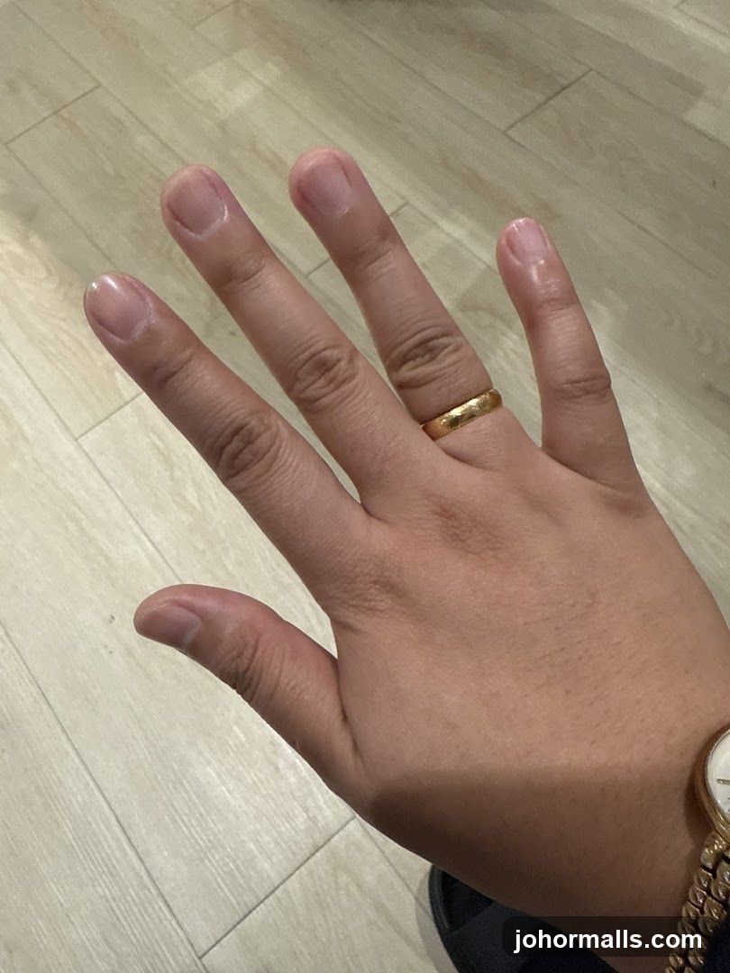 Hand with Ring and Watch