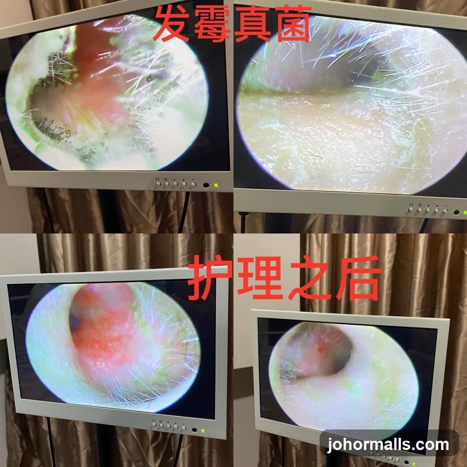 Medical Endoscopic Images
