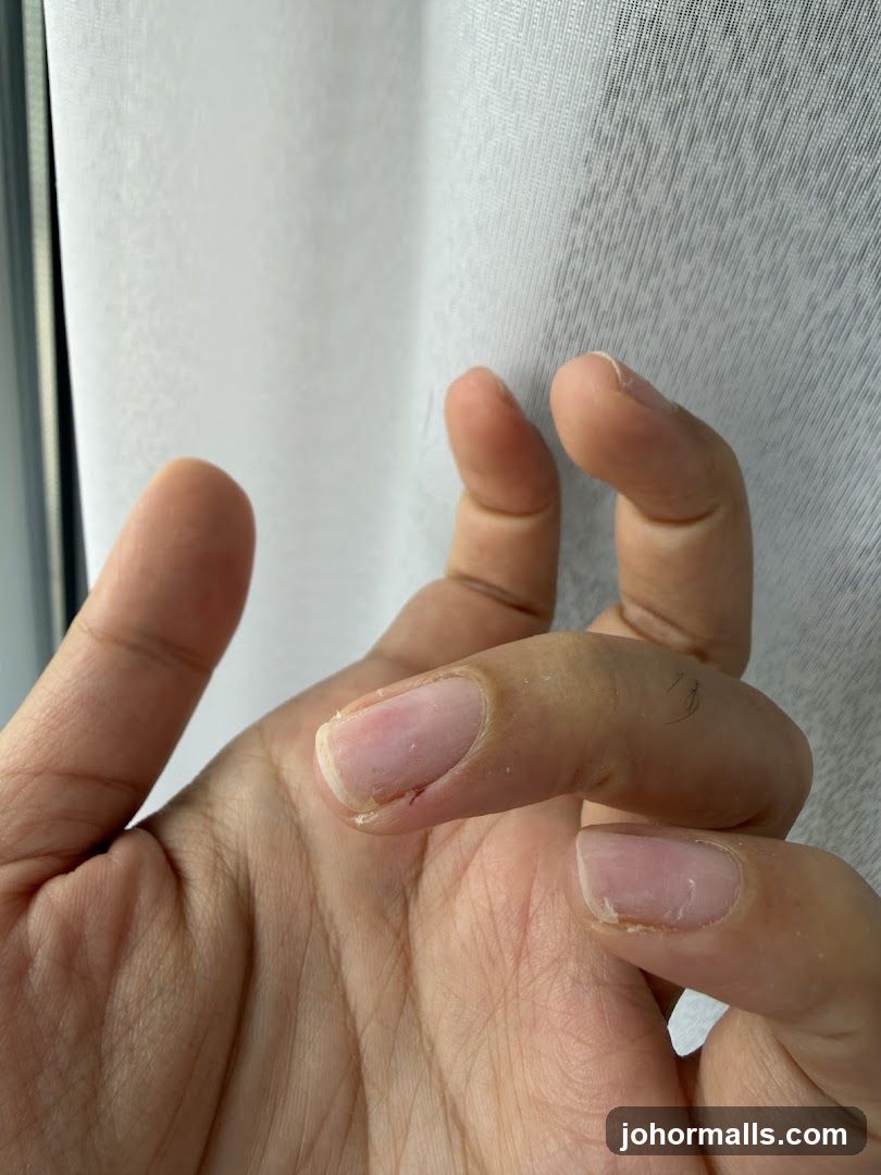 Close-up of a hand with unkempt nails