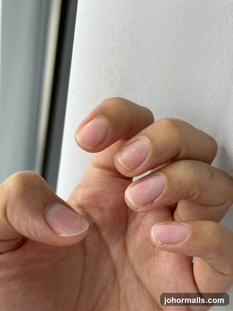 Close-up of a hand with unpolished nails