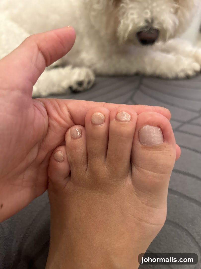Close-up of toes with a dog in the background