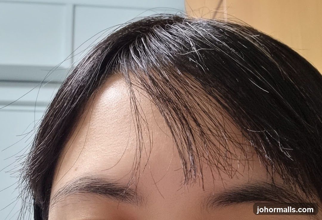 Forehead and Hair