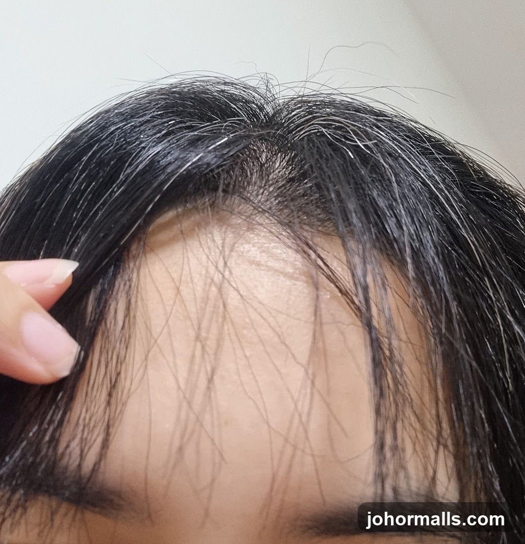 Hairline