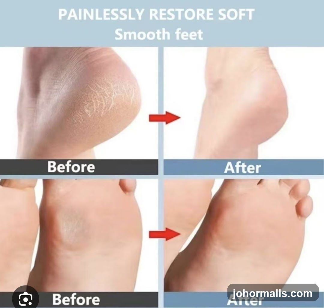 Before and After Foot Treatment