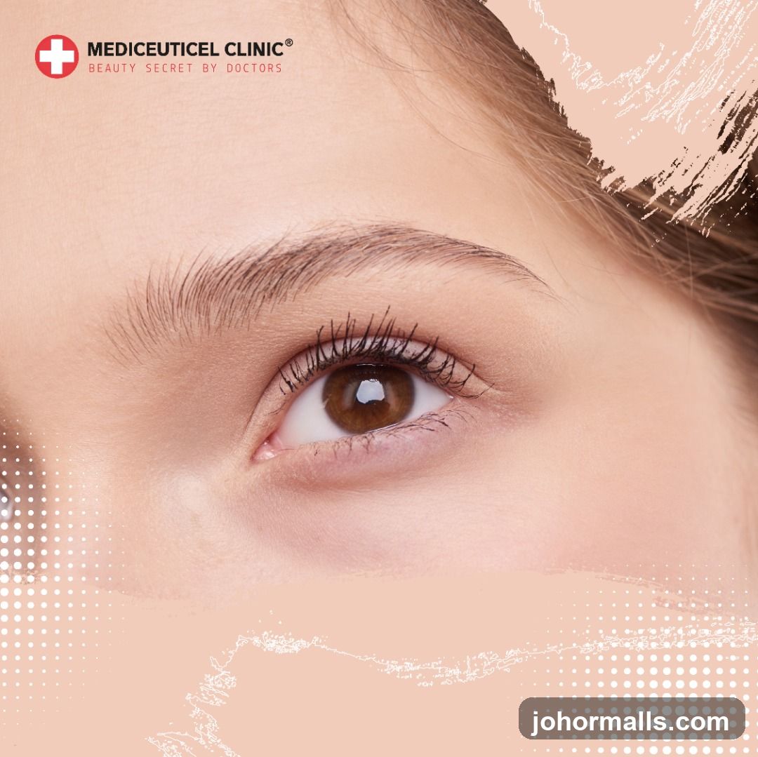 Close-up of an eye with clinic branding