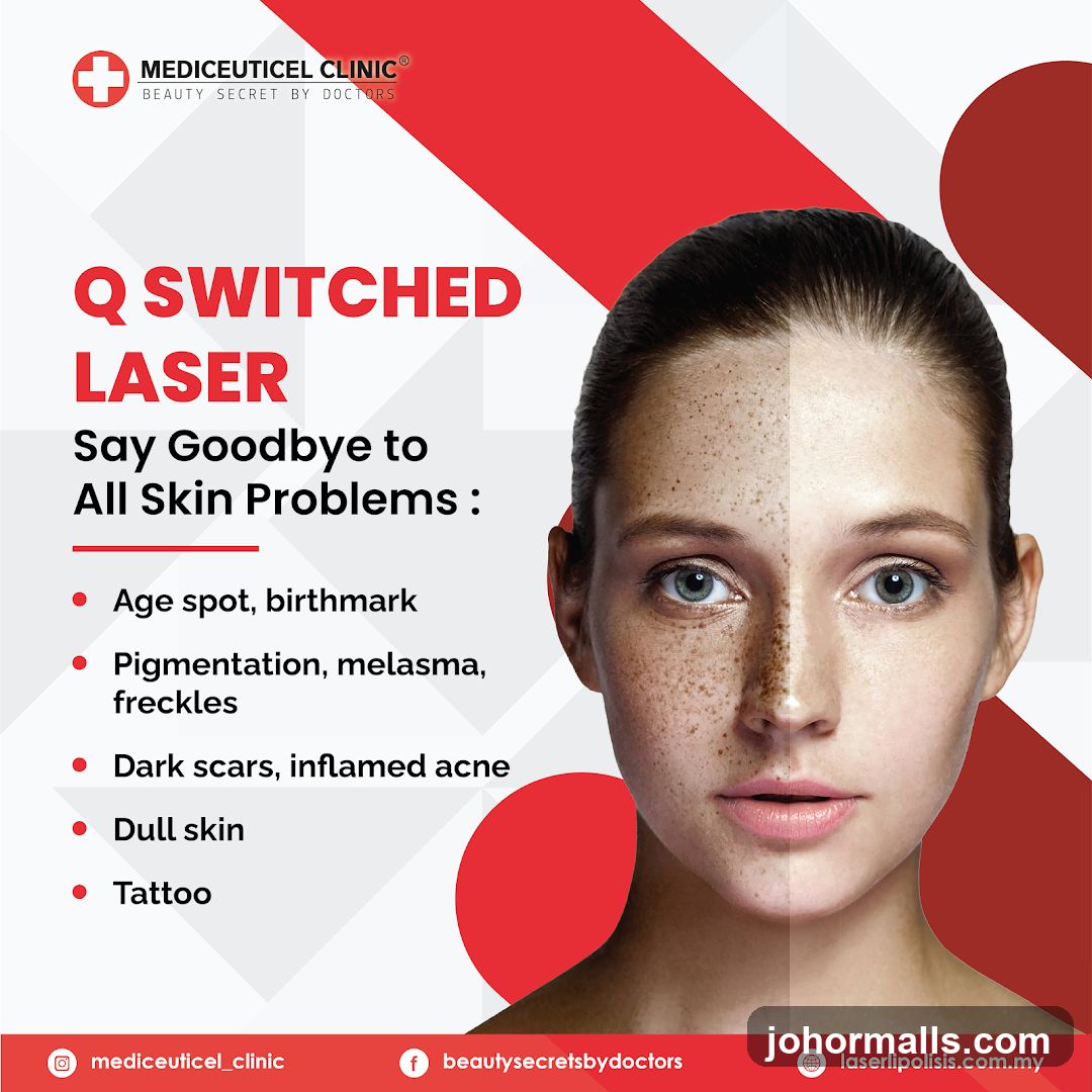 Q Switched Laser Treatment