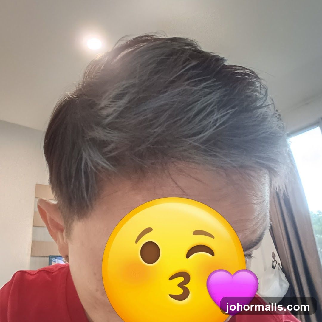 Person with emoji covering face